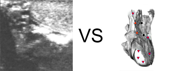 Comparison with ULTRASOUND STUDY 14