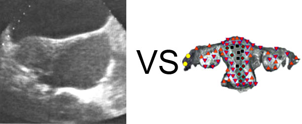 Comparison with ULTRASOUND STUDY 16