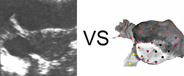 Comparison with ULTRASOUND STUDY 17