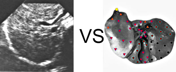 Comparison with ULTRASOUND STUDY  3