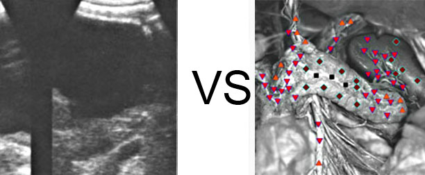 Comparison with ULTRASOUND STUDY 7
