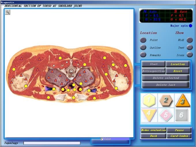 3d nls scanner
