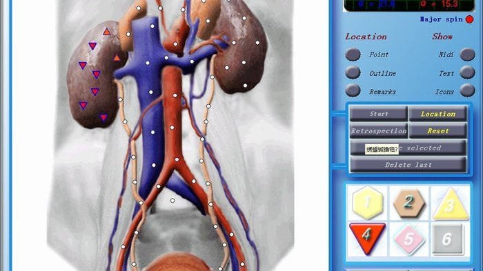 3d nls scanner