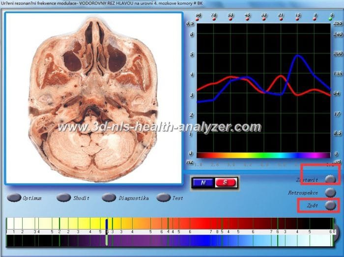3d nls non linear diagnostic system