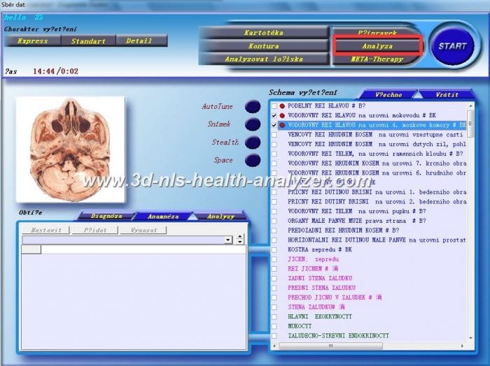 3d nls non linear diagnostic system