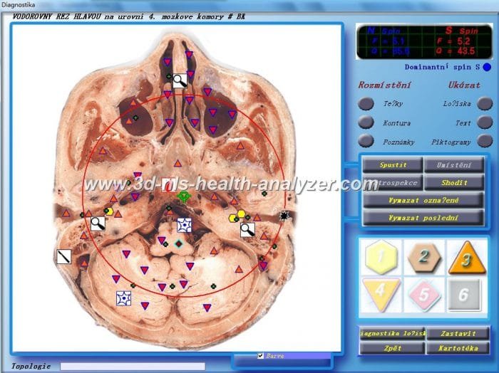3d nls non linear diagnostic system