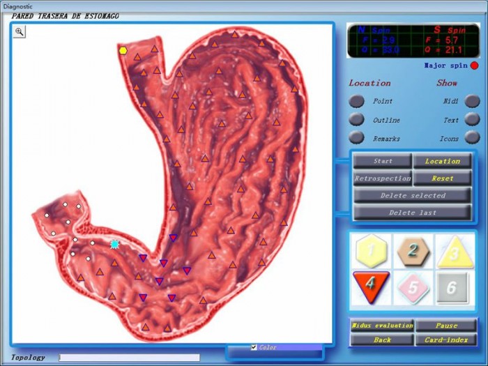 2013 3D NLS Sub Health Analyzer 4
