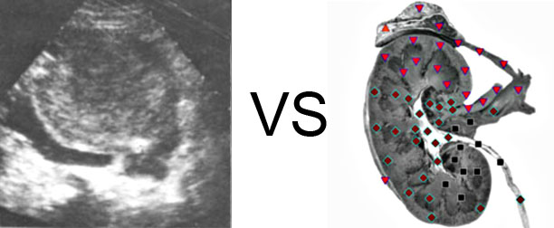 Comparison with ULTRASOUND STUDY 10