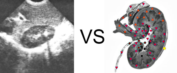 Comparison with ULTRASOUND STUDY 11