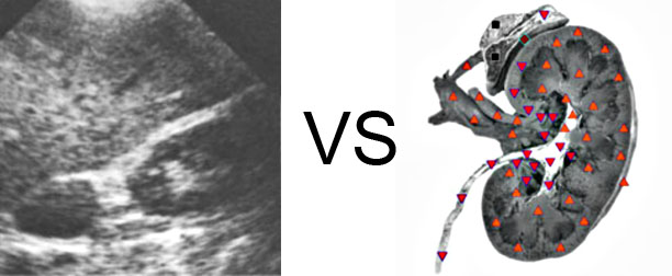 Comparison with ULTRASOUND STUDY 12