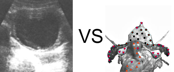 Comparison with ULTRASOUND STUDY 13