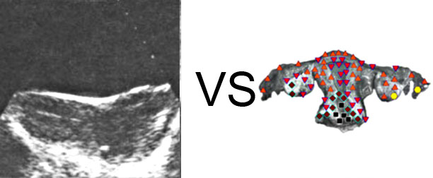 Comparison with ULTRASOUND STUDY 15