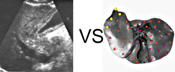 Comparison with ULTRASOUND STUDY 2