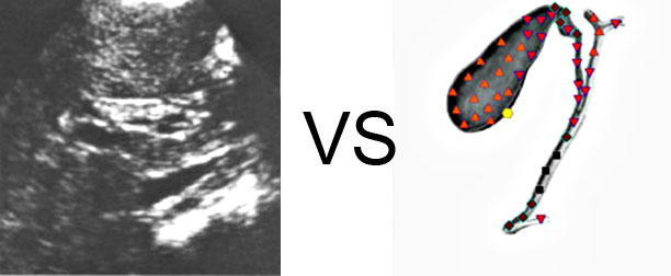 Comparison with ULTRASOUND STUDY 4
