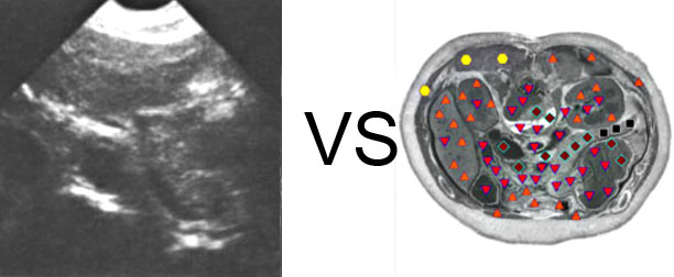 Comparison with ULTRASOUND STUDY 6