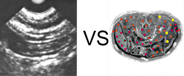 Comparison with ULTRASOUND STUDY 8