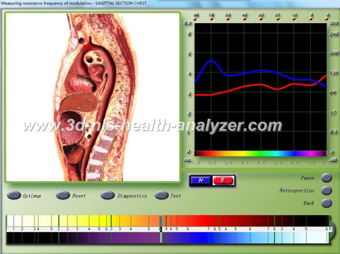 3d nls health analyzer video