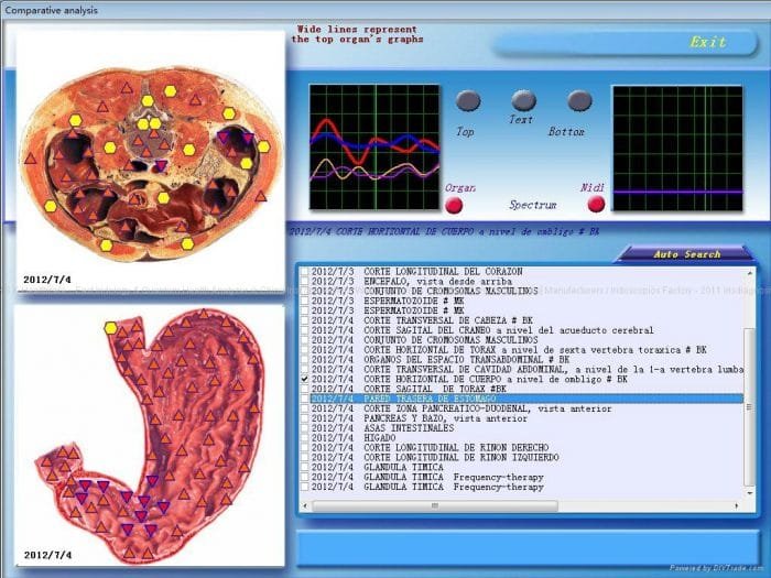 diacom nls software 15