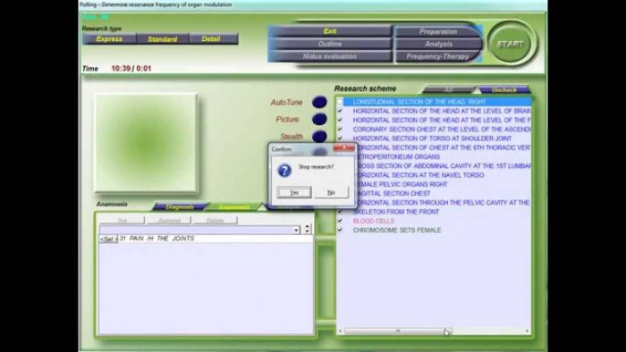 diacom nls software 6