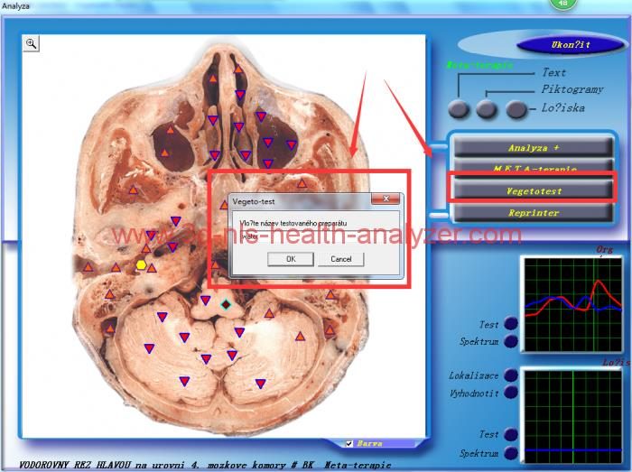 3d cell nls diagnostic and analysis