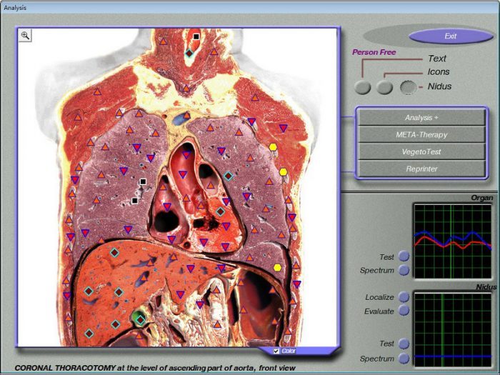 health diagnostic scanner 3d