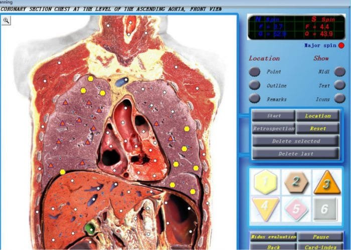 3d nls quantum health analyzer