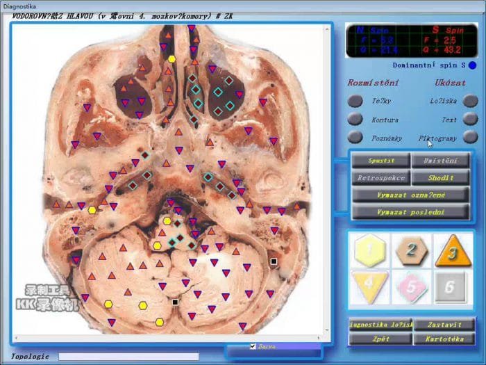 3d nls health analyser Supplier