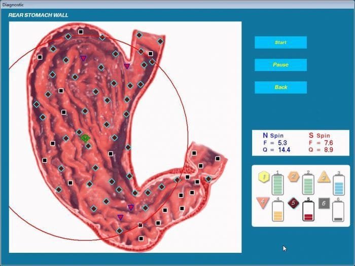 3d nls health analyser Supplier