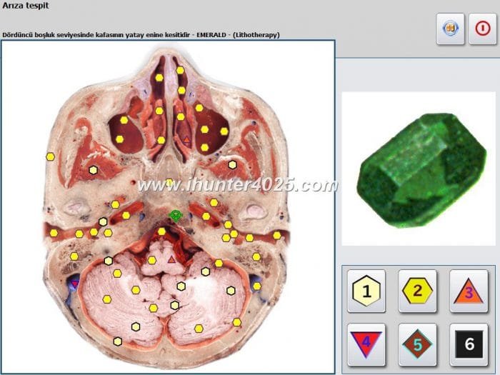 nls diagnostic and analysis