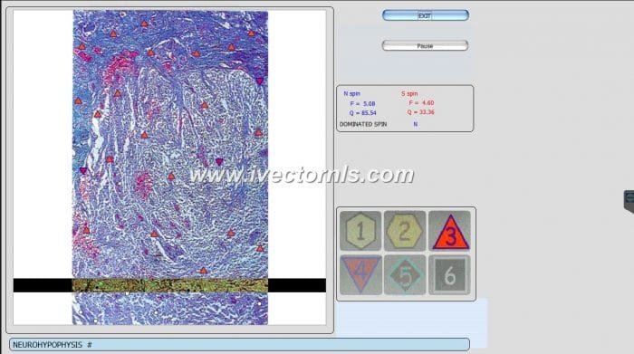 Metatron Diagnostic Machine Review