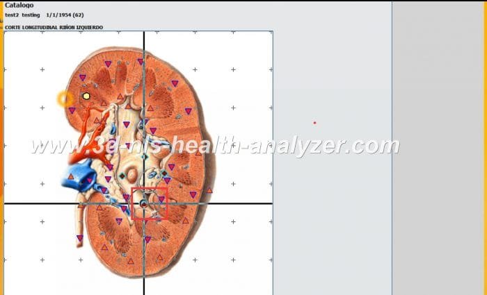 metatron nls diagnostic