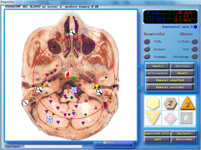 3D NLS Health Analyzer