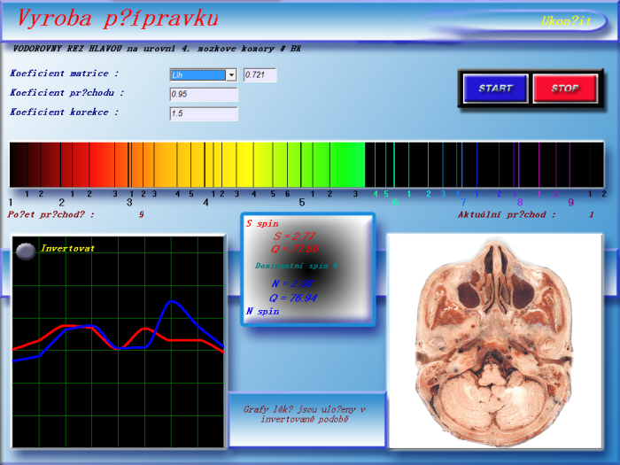 3D NLS Health Analyzer