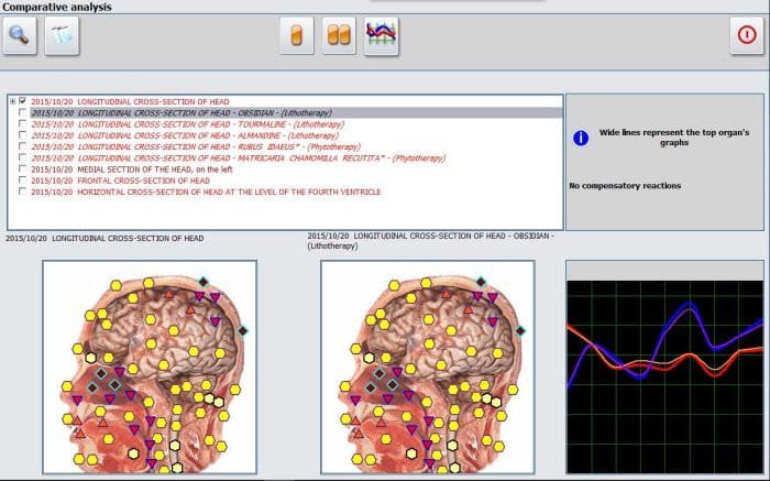 Metatron NLS Scanner